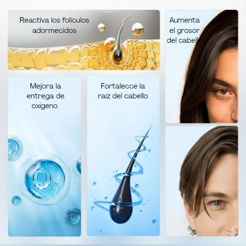 Bodywise™: Sérum para el crecimiento del cabello